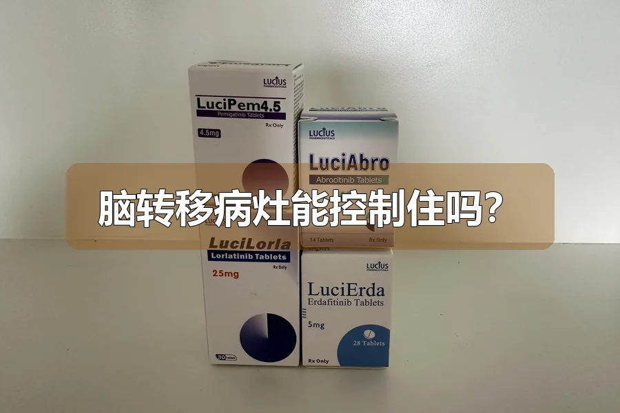 脑转移病灶能控制住吗？